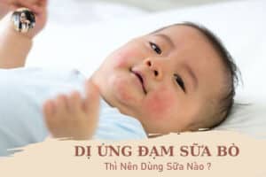 Bé Bị Dị Ứng Đạm Sữa Bò