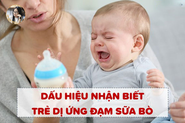 Bé Bị Dị Ứng Đạm Sữa Bò